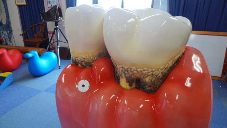 虫歯になるとこうなる