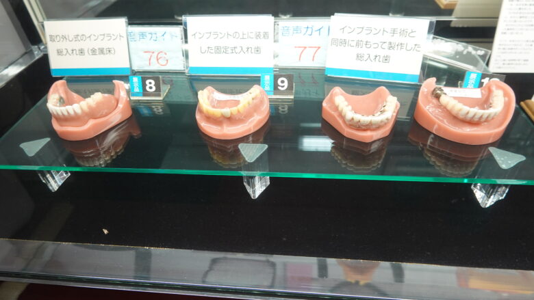 取り外し式のインプラント総入れ歯(左)、インプラントの上に装着した固定式入れ歯(左から2つ目)