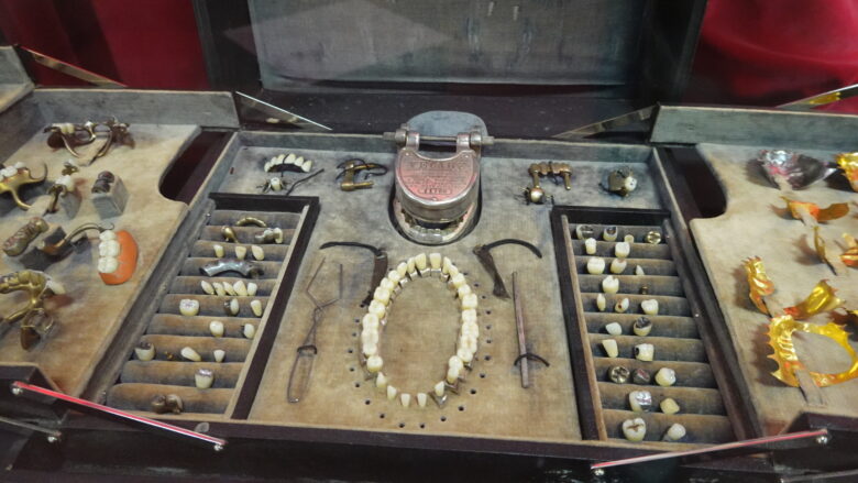 貴重なデモンストレーション用義歯モデルがあるぞ(120年前にドイツで作成)