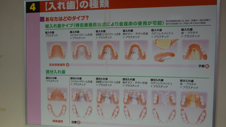 入れ歯はたくさんの種類がある
